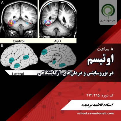 نوروسایکولوژی و درمان‌های ازمایشگاهی برای اختلالات طیف اوتیسم - کد 414/415