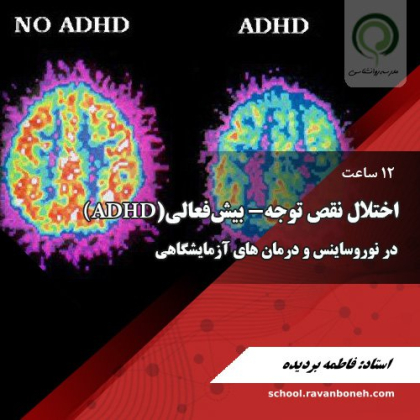 نوروسایکولوژی و درمان‌های ازمایشگاهی برای اختلال نقص توجه_ بیش فعالیADHD - کد 414/416